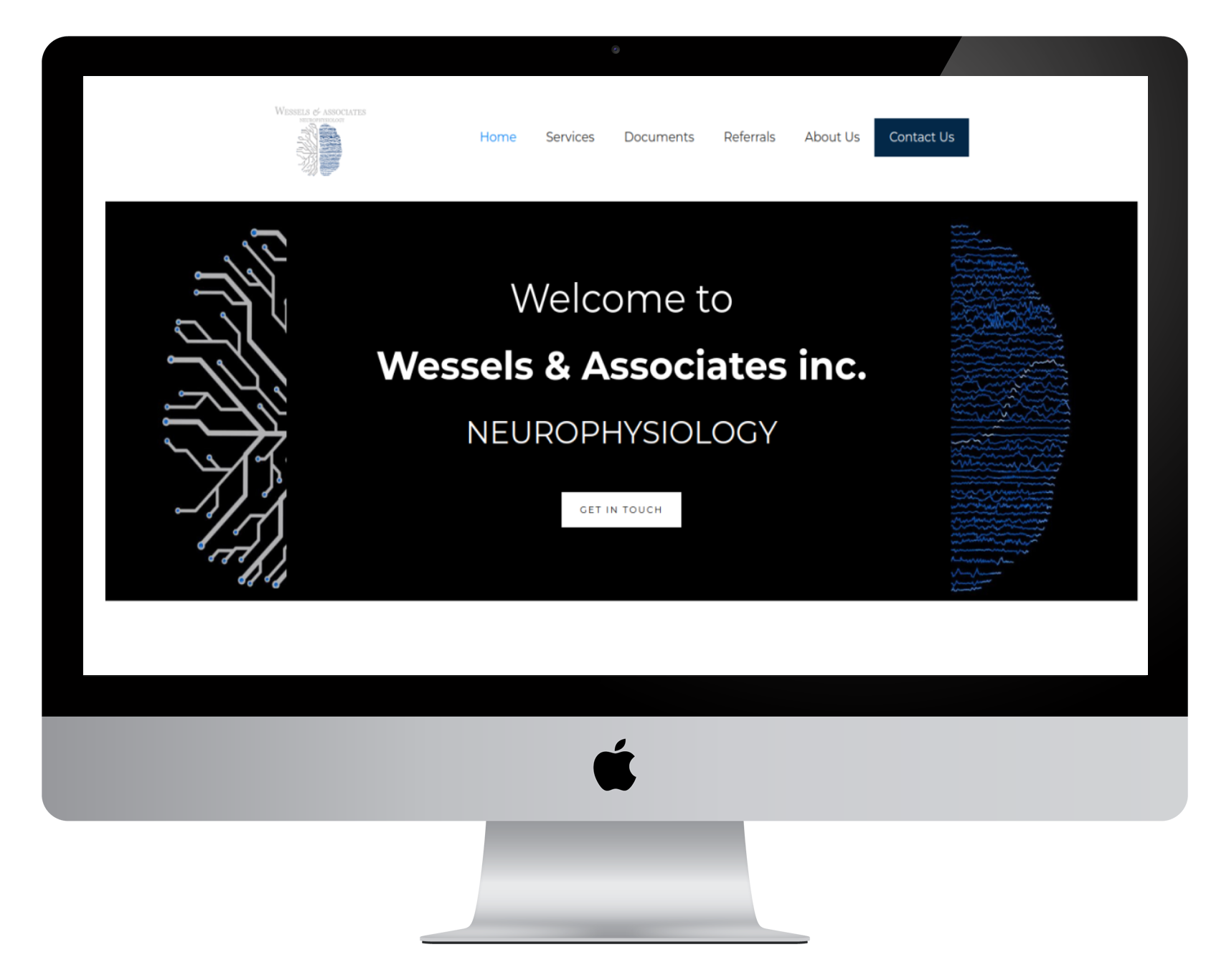 WA Neurophysiology